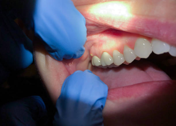 Best Broken Tooth Emergency  in Alexandria, IN