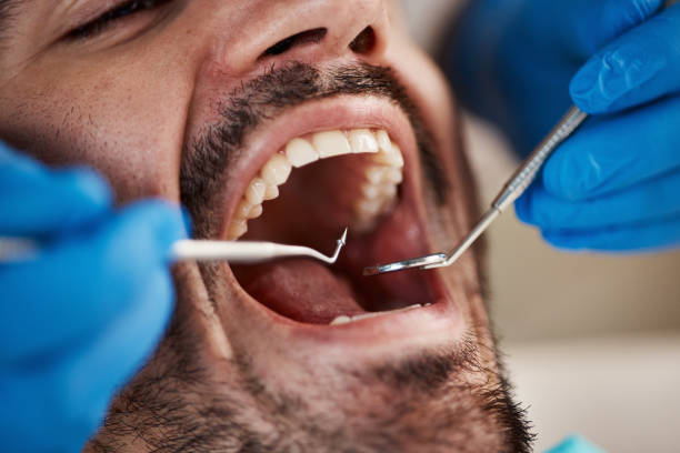 Best Knocked-Out Tooth Emergency  in Alexandria, IN